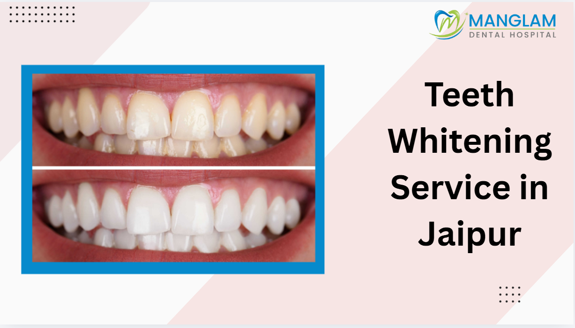 laser teeth whitening service in Jaipur